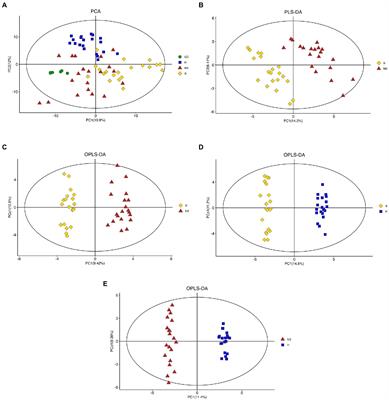 Differential metabolites in cirrhotic patients with hepatitis B and muscle mass loss